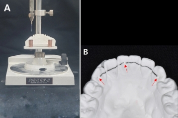 Custom digital retainers