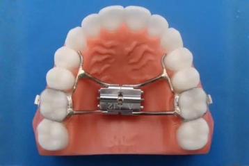Hyrax-type expanders