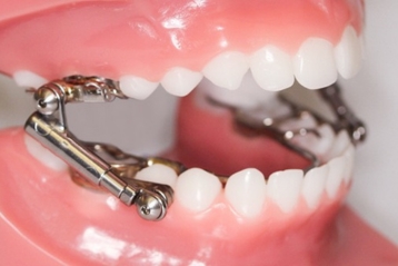 Fixed Non-Compliance Appliances