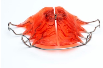 Removable Functional Appliances